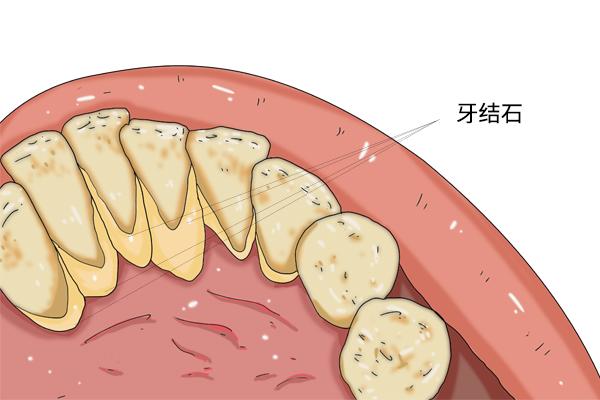 口水那么恶心，为什么情侣接吻一点不嫌弃？人到中年口臭怎么办？