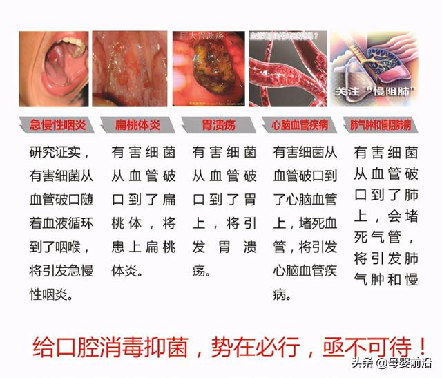 儿童牙膏的“智商税”