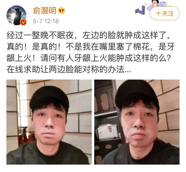 从“人见人爱”美男子，到烧伤毁容“丑八怪”，俞灏明现状如何？